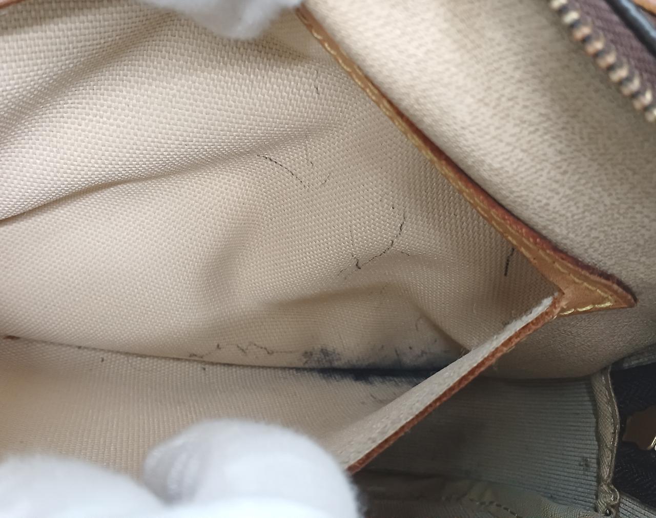 すごく黒いシミです！結構広がっております