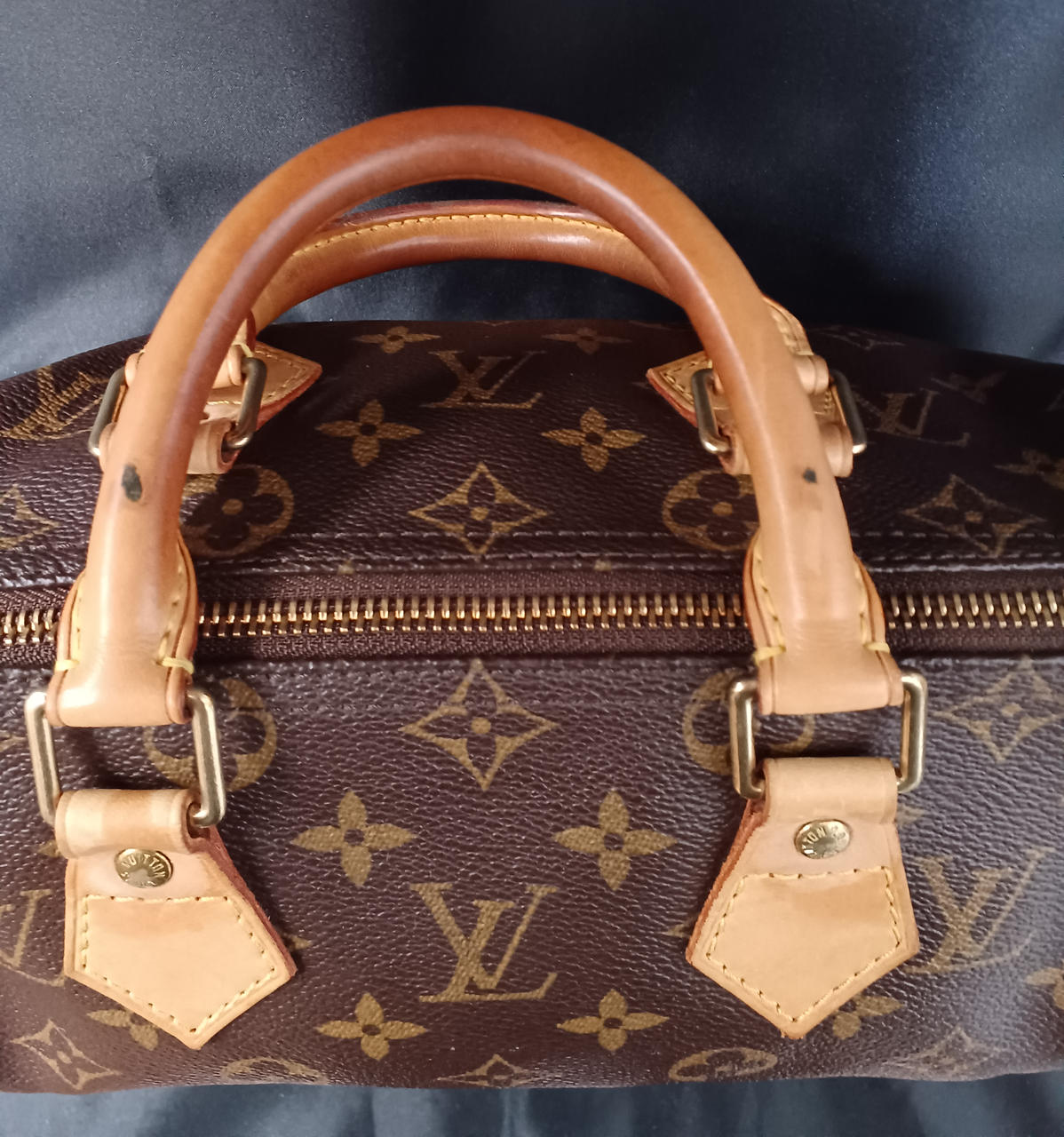 シミ、日焼けあり