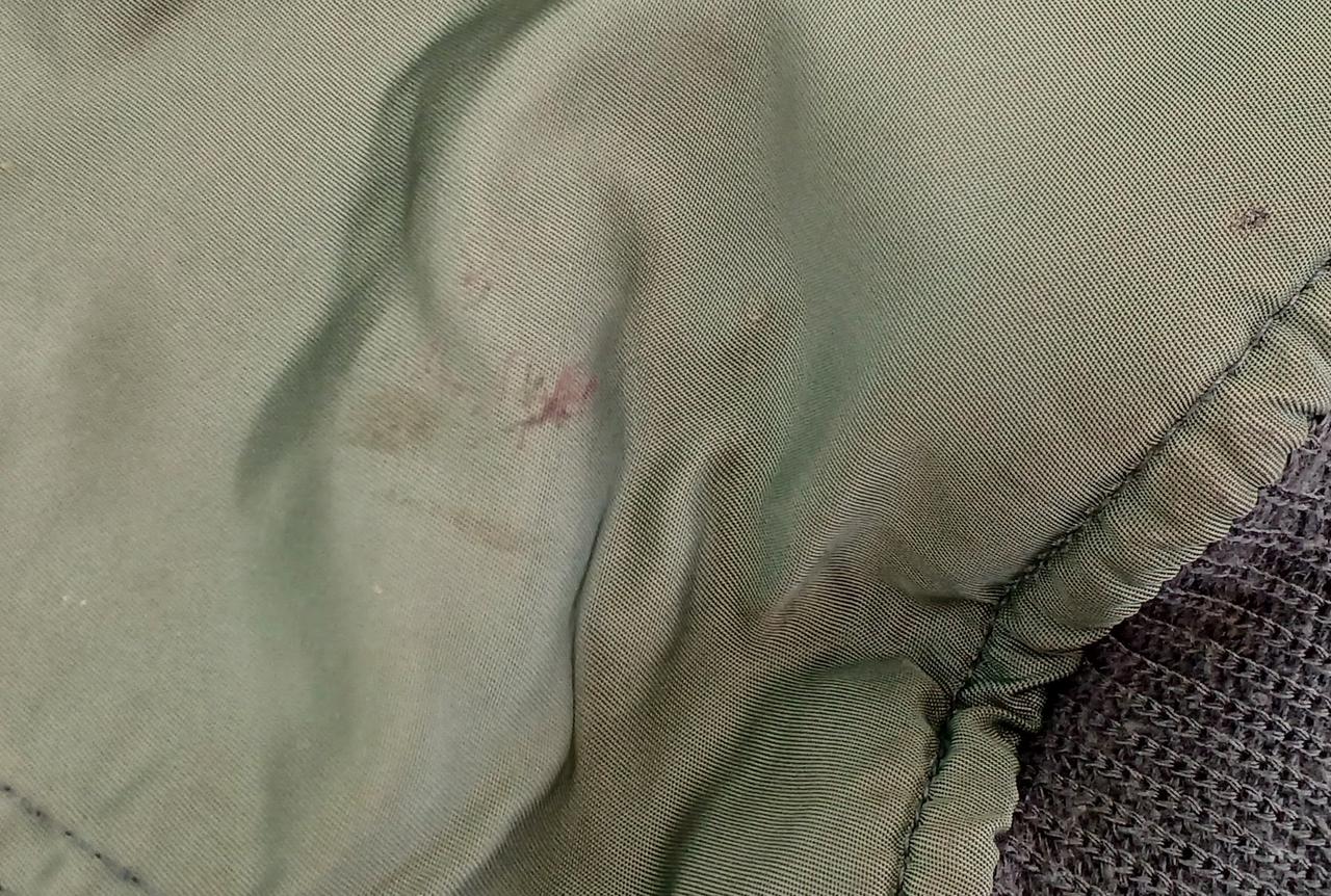 左腕な袖付近に汚れあり
