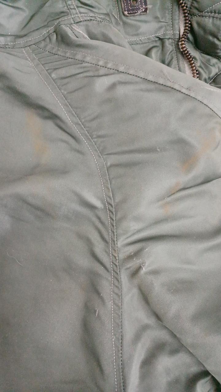 右肩背中側に汚れあり