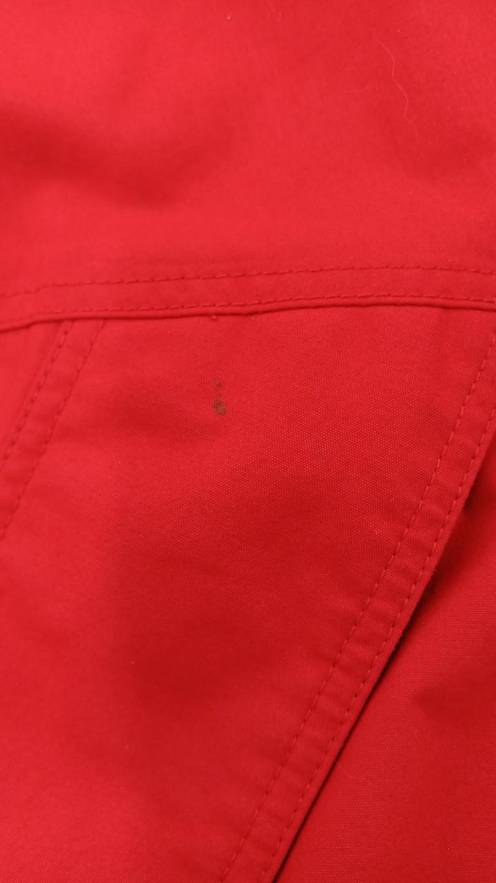 右胸に汚れあり