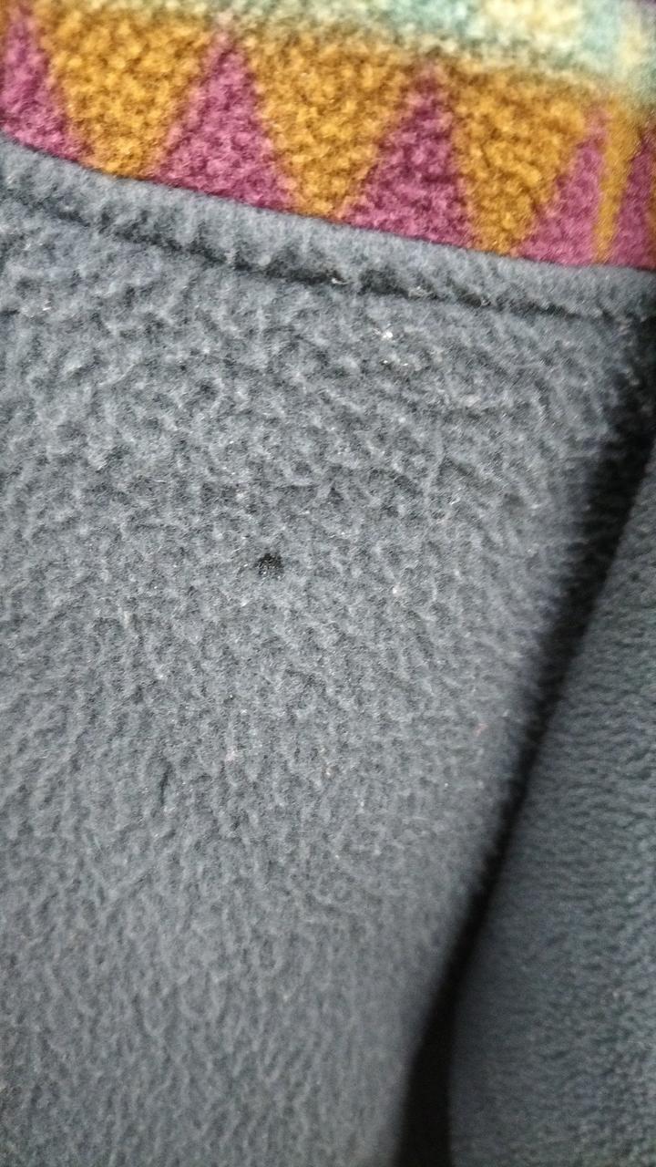 ハゲがあります