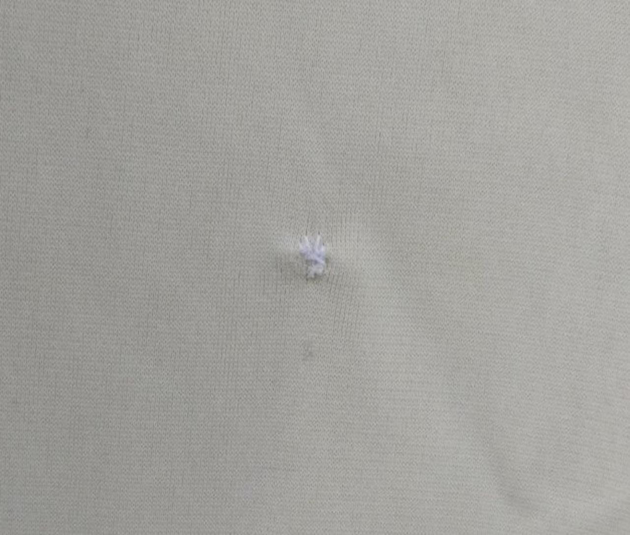 左胸部分補修跡あり