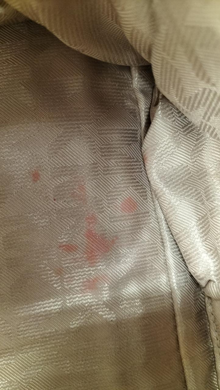 ピンクシミあり