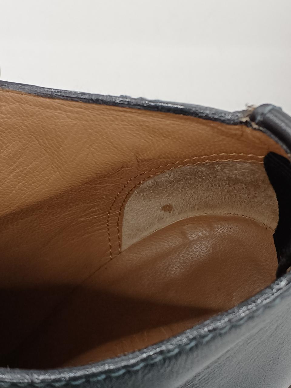 左足の内側シミあり