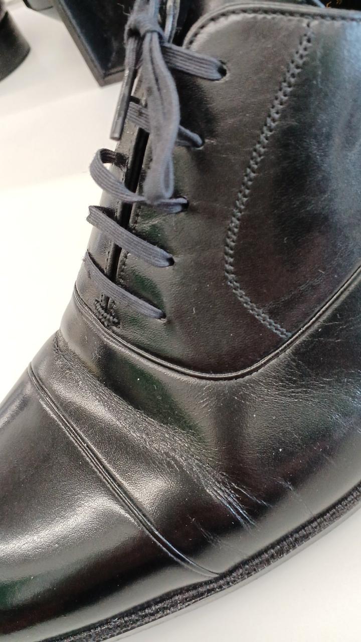 シワがあります