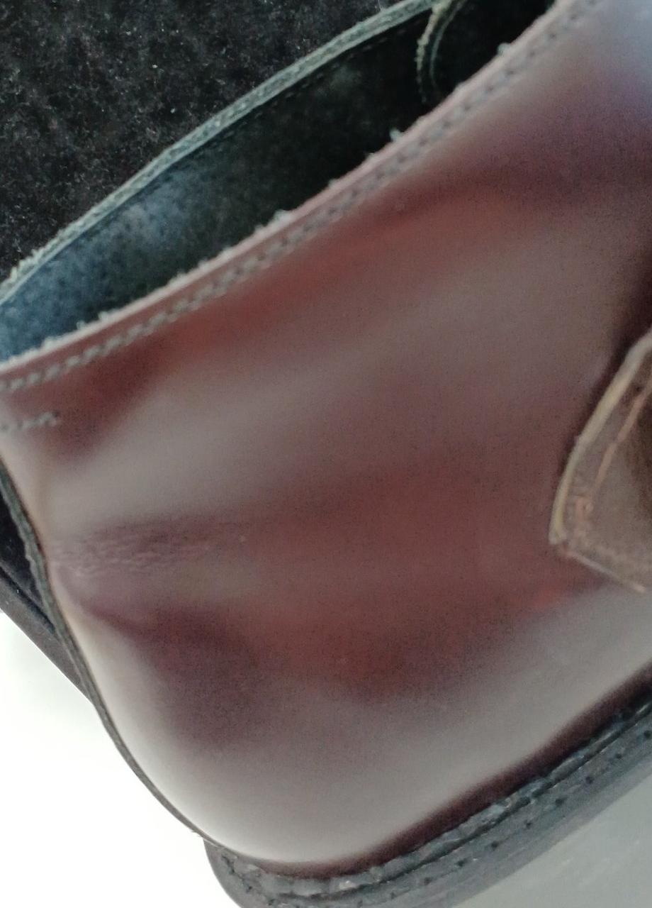 左足内側にシワがあります