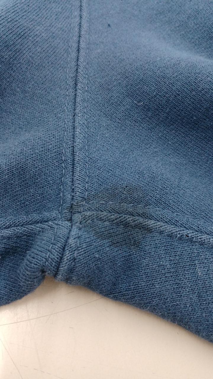 股下染み（表側）