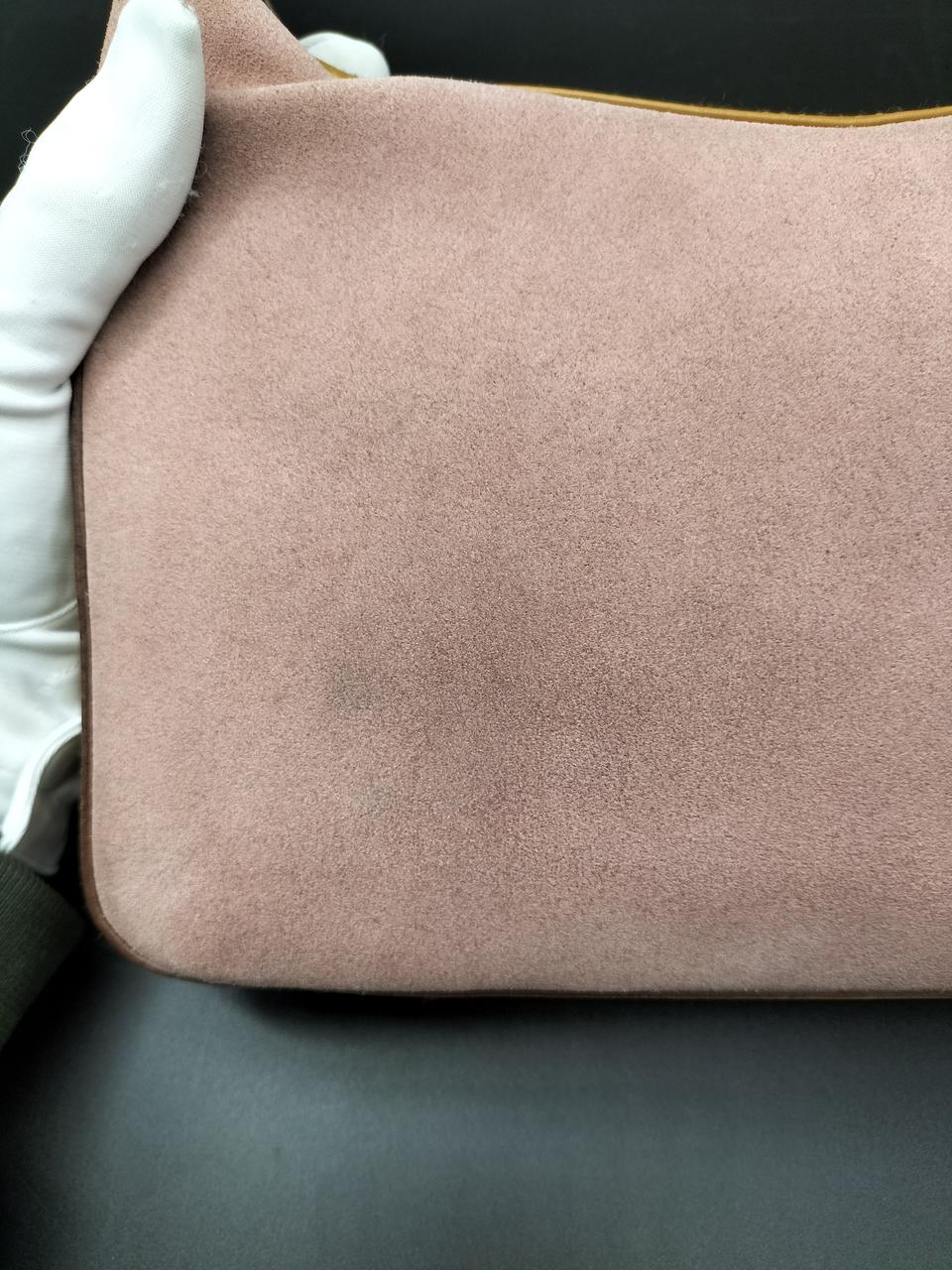 黒ずみあります