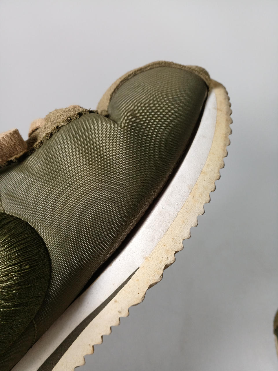 両足とも、剥がれてきています。