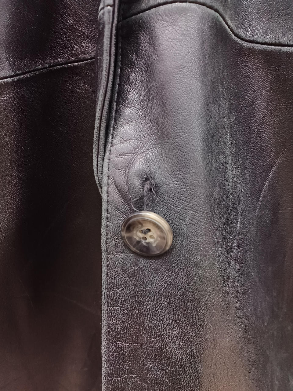 一番下のボタンとれかけています