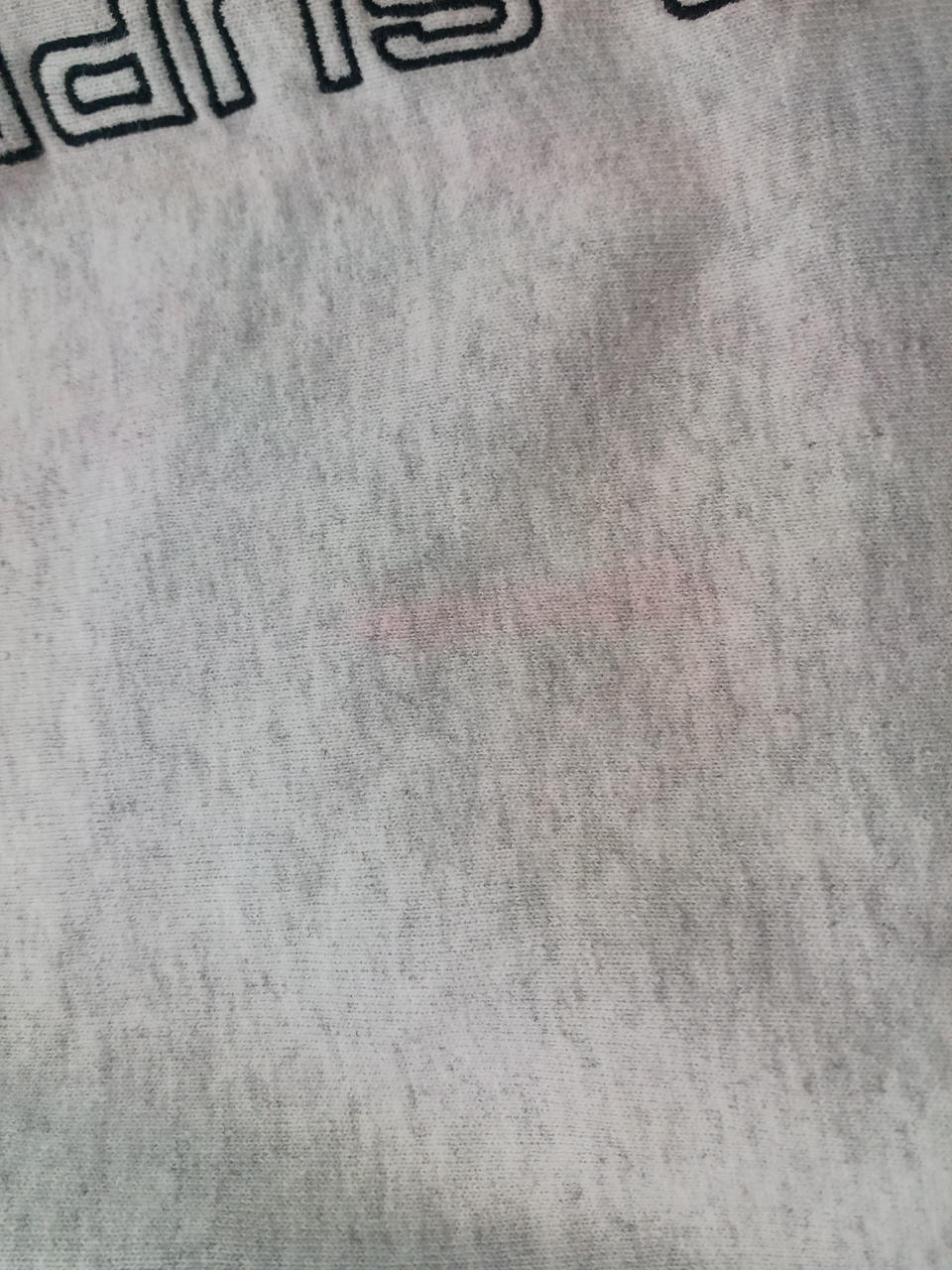 ピンクのシミあり