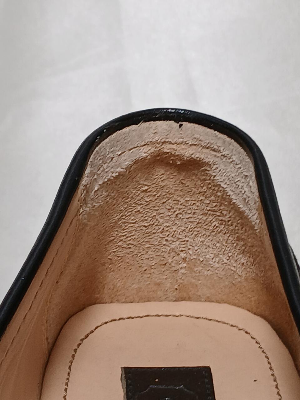 左足内側踵部分です。