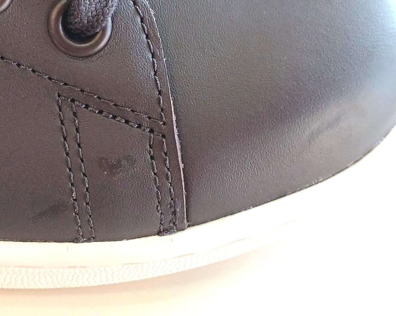 右小指付近に傷あり