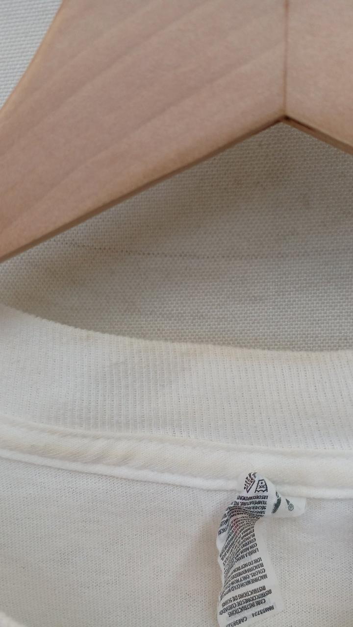 黄ばみ