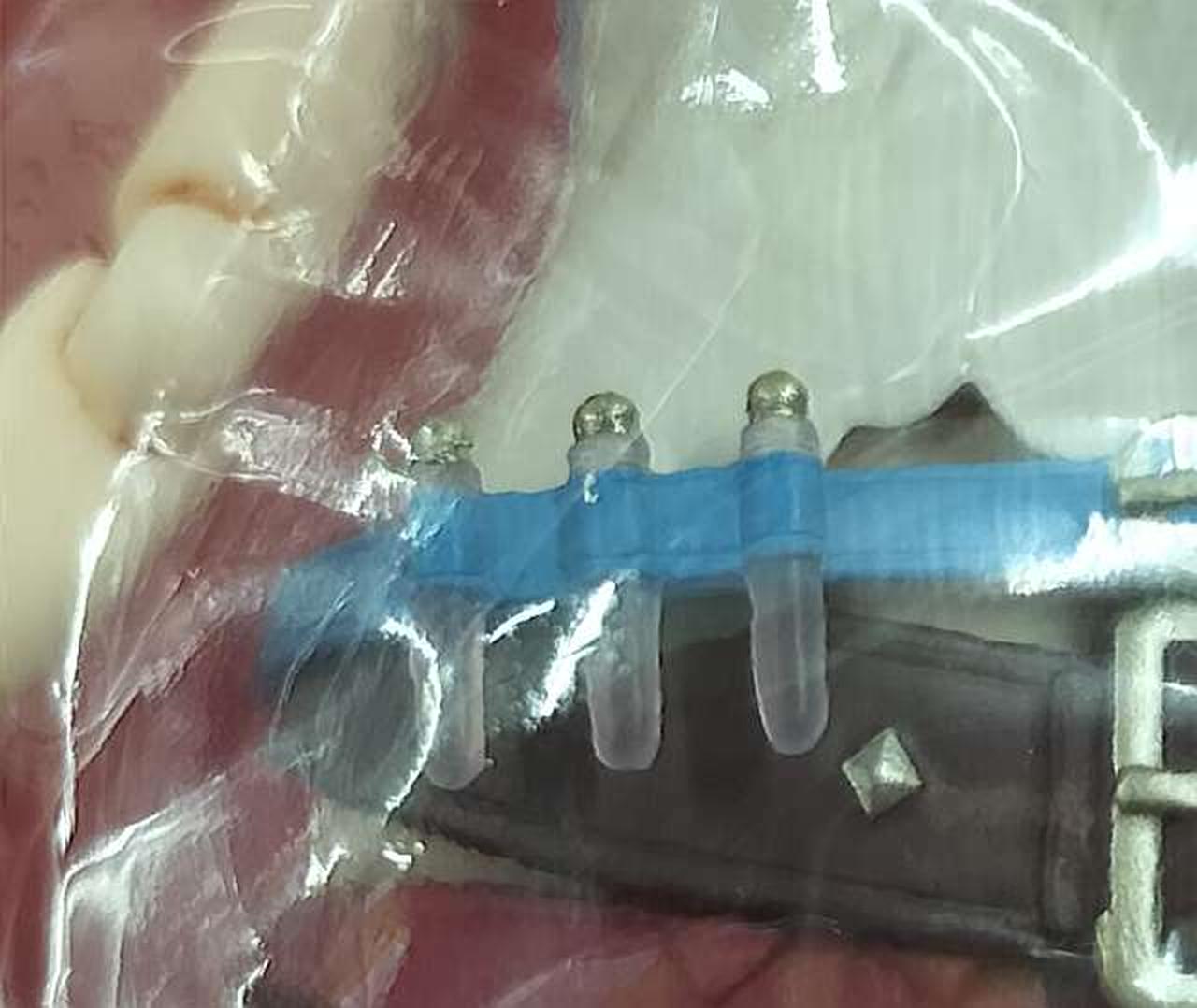 試験管初期不良