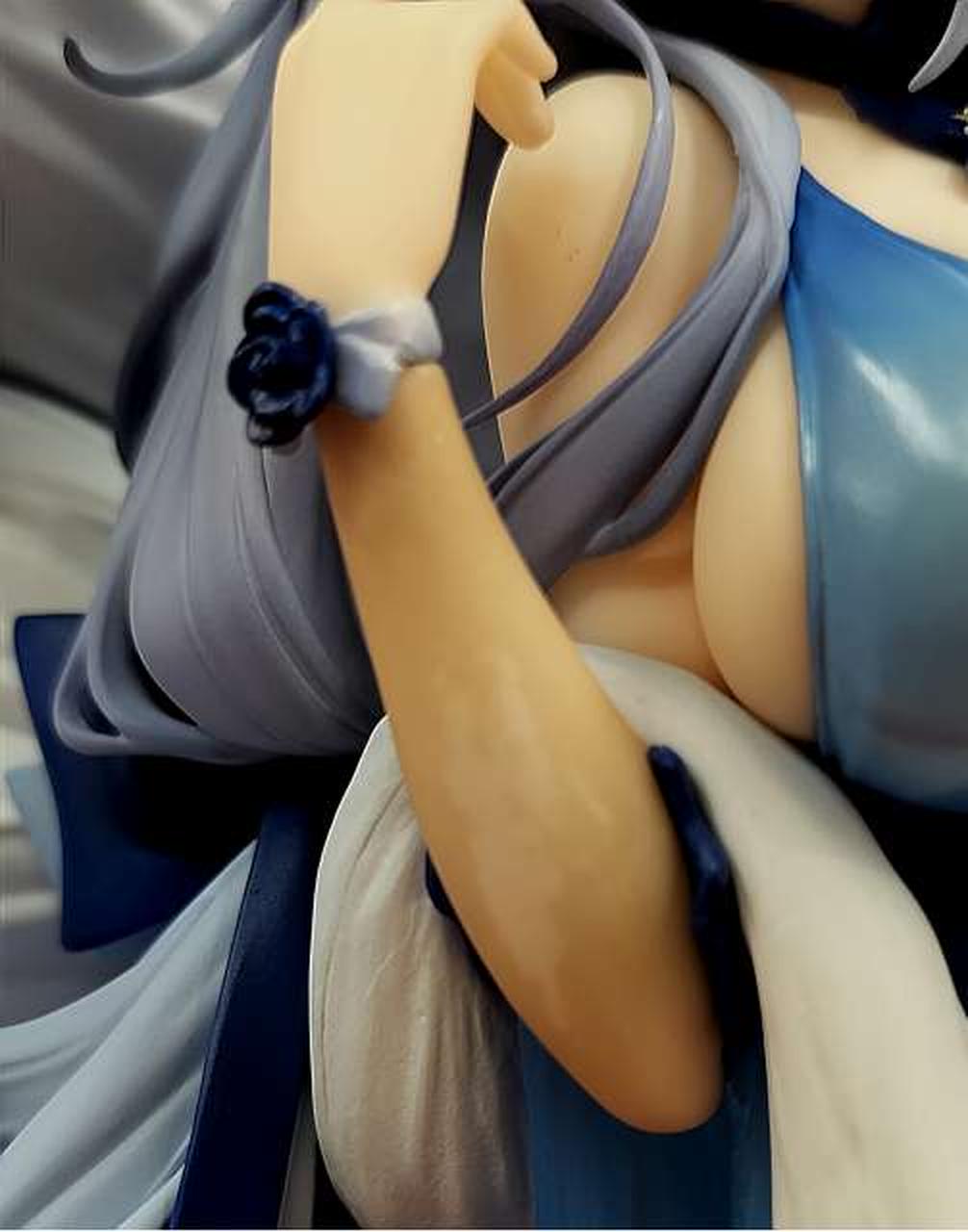 右腕部変色あり