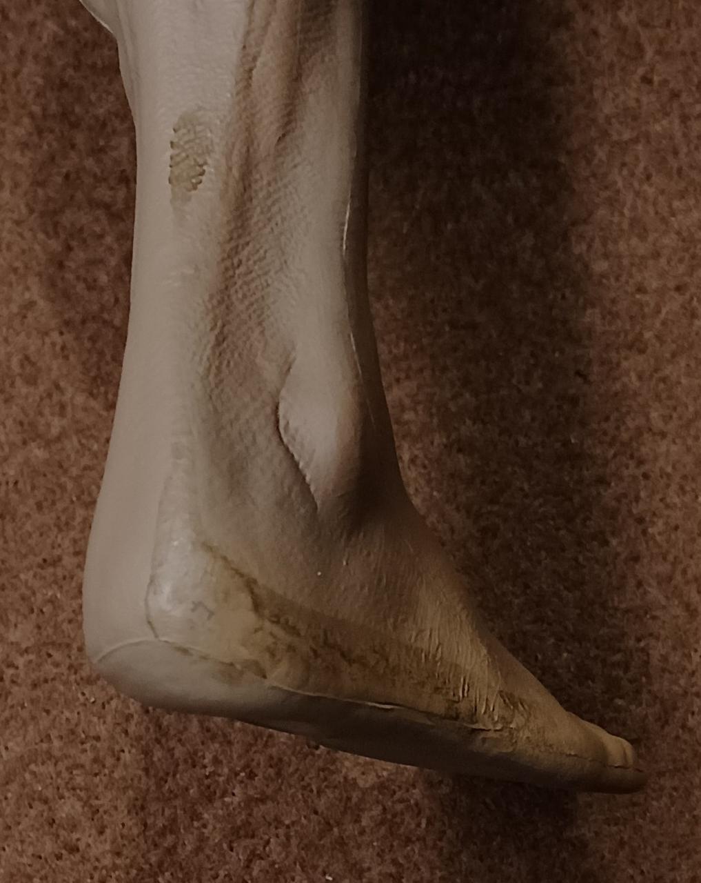 汚れがあります。