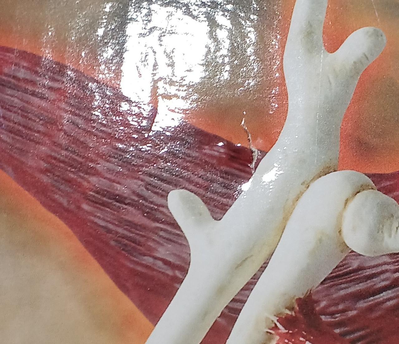 破れています。