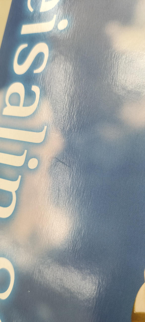 線状の凹みがあります