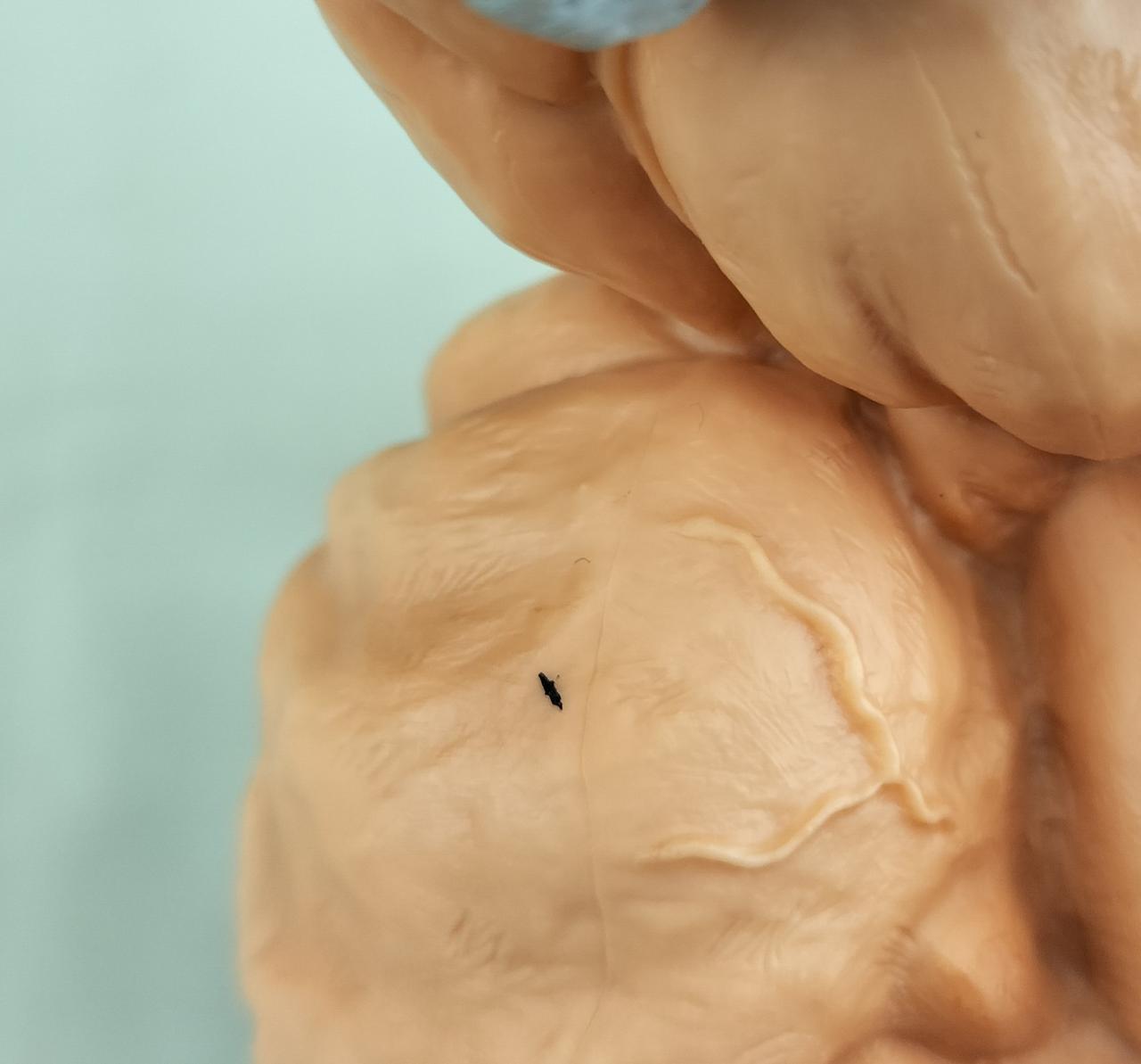 わかりにくいですが、左脇の辺りです。