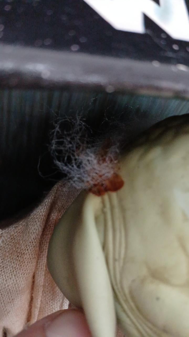 髪の接着剤経年劣化による変色有