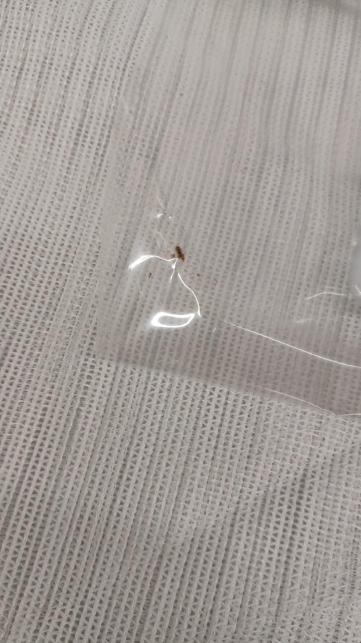 内袋未開封ですがゴミが入ってます